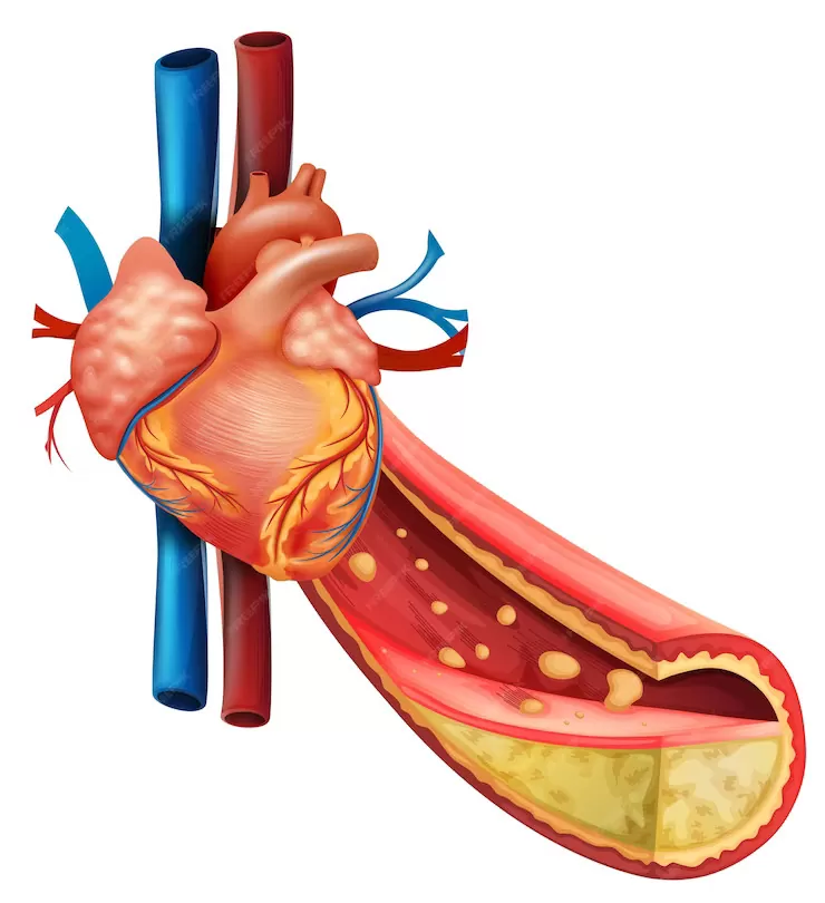 Coronary Angiography in Jaipur