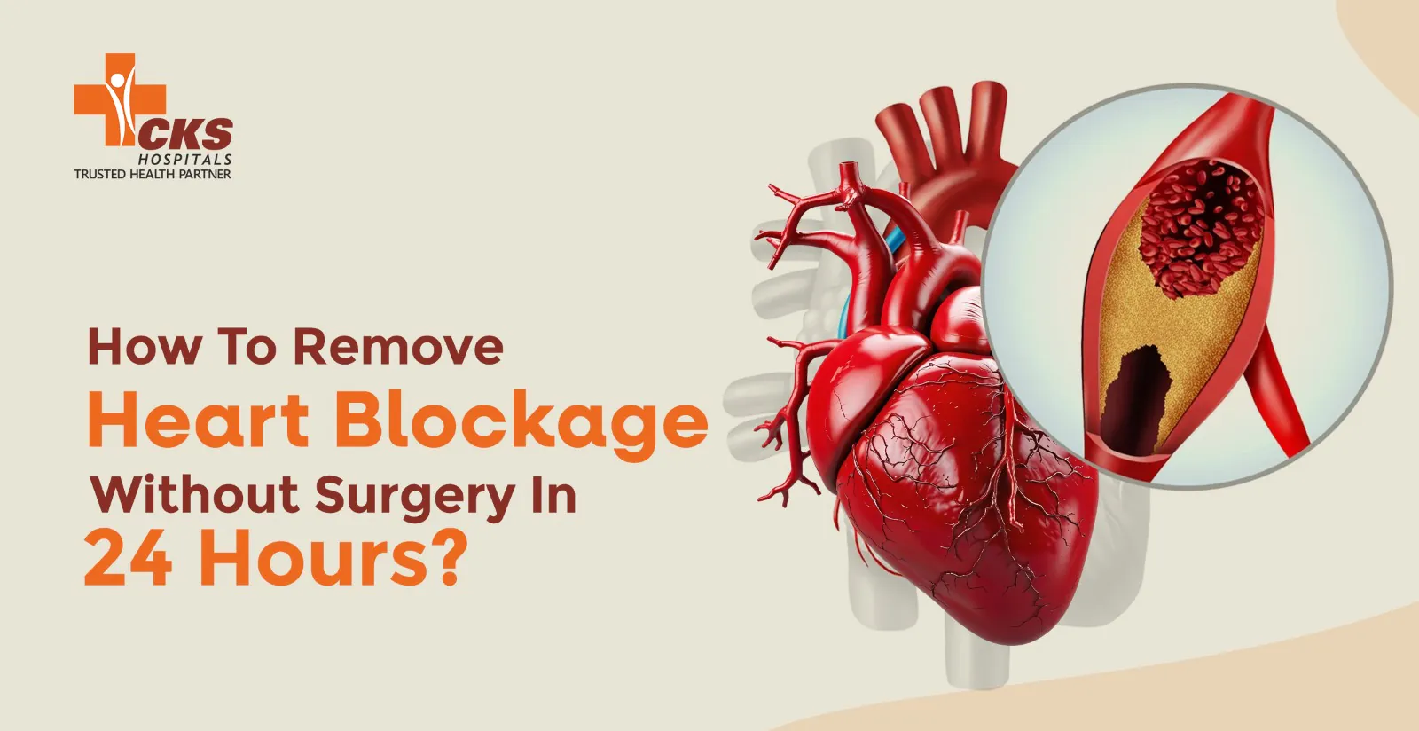How To Remove Heart Blockage Without Surgery In 24 Hours?